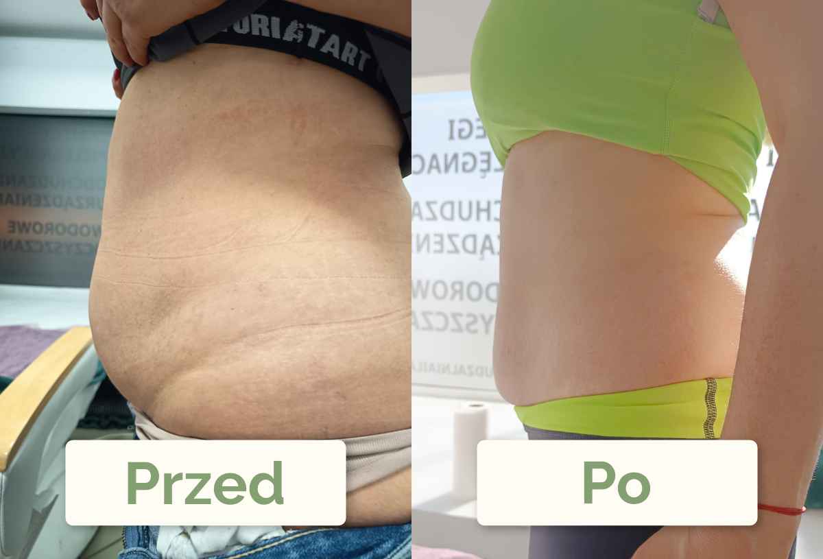 Metamorfoza Klientki z boku