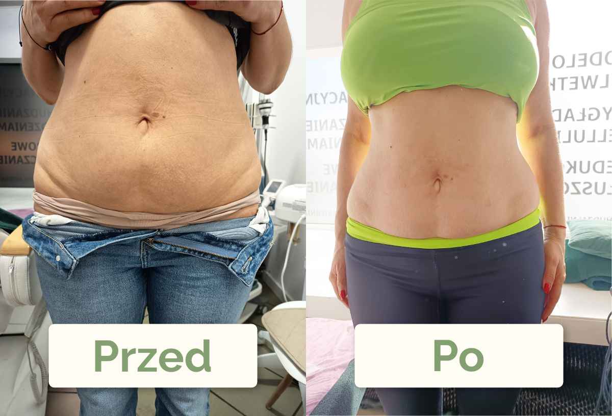 Metamorfoza Klientki z przodu