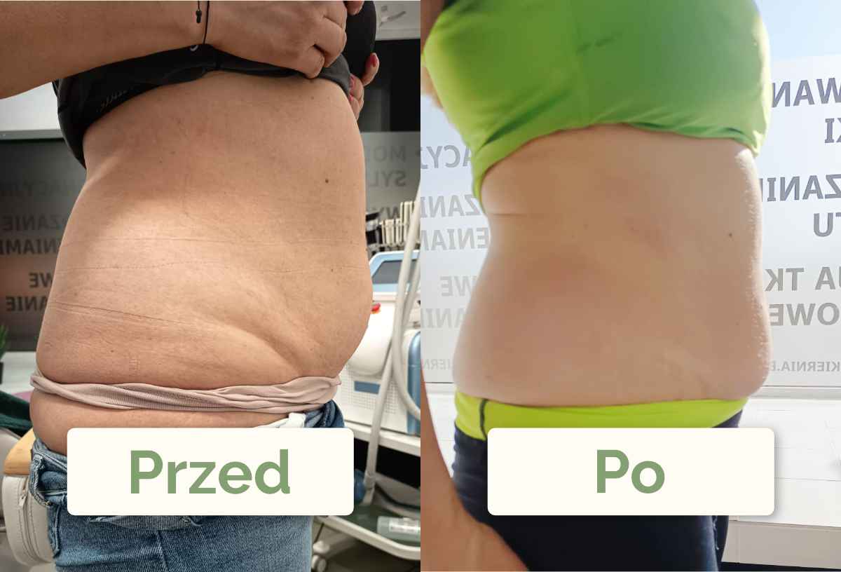 Metamorfoza Klientki z boku